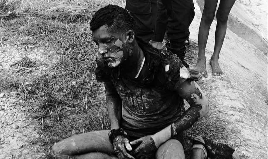 रुबी हत्या प्रकरण : लक्ष्मणको मृत्युले अनुसन्धान फाइल बन्द हुने जोखिम