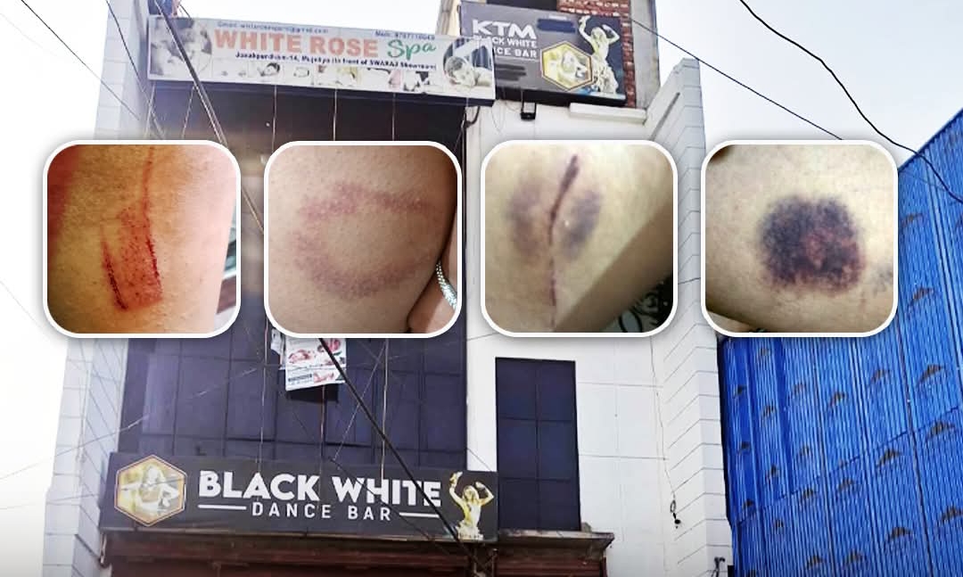 जनकपुरको डान्स बारमा यौनकार्य अस्वीकार गर्दा युवतीमाथि निर्घात कुटपिट, मानव बेचबिखन मुद्दा चलाउने तयारी